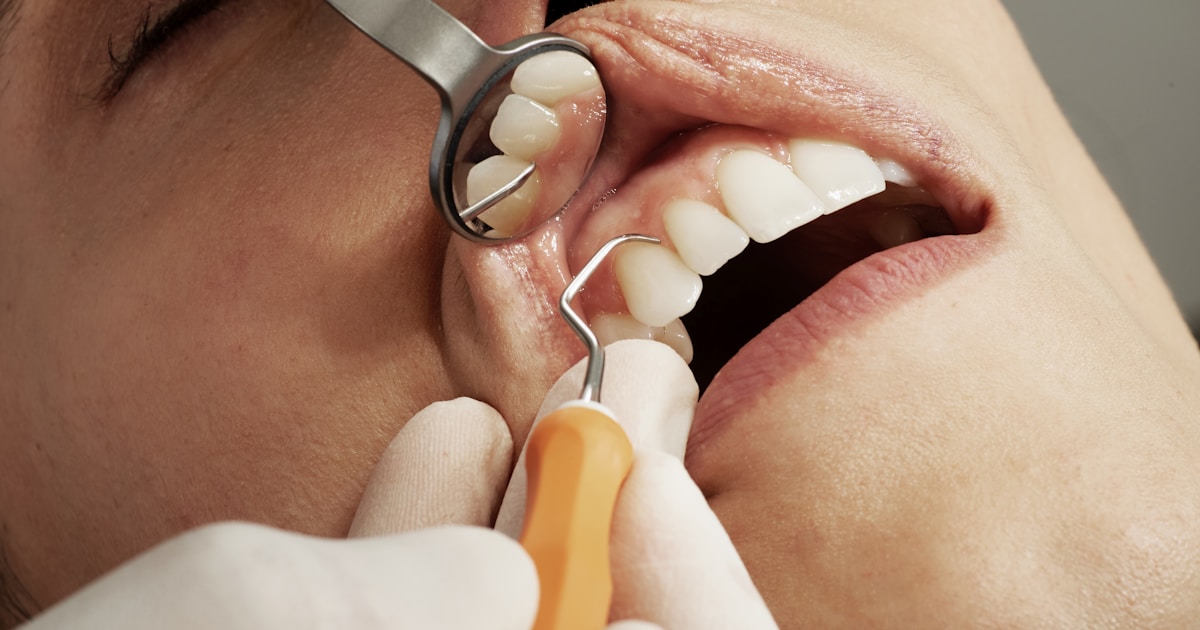Preventing and Treating Gum Disease with Braces: Essential Oral Hygiene Tips