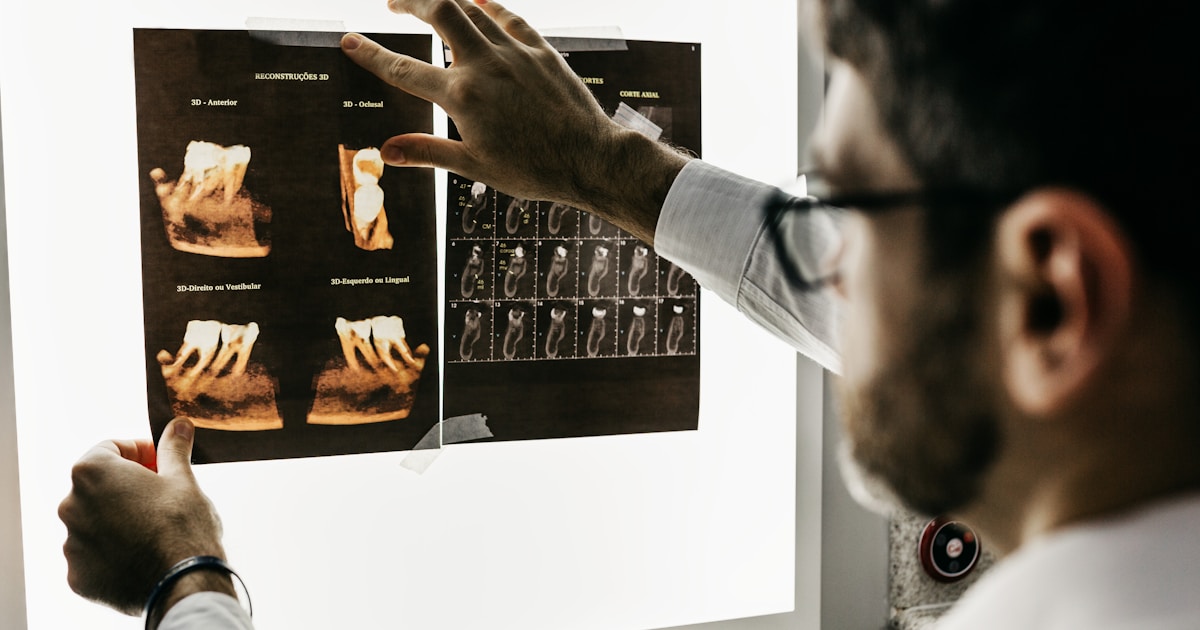 Why Orthodontic Dental Retainers Fail More Often Than Patients Expect